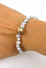 baroque japan kasumi and blue keshi pearl bracelet